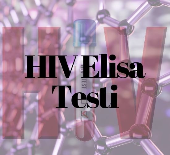 HIV Elisa Testi